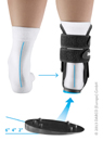  ankle brace for injuries of the deltoid sprains, of the posterior tibial tendon, after flatfoot reconstruction